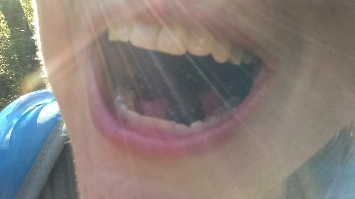 Sunbeams, Berries and Shaggy&nbsp;Bark